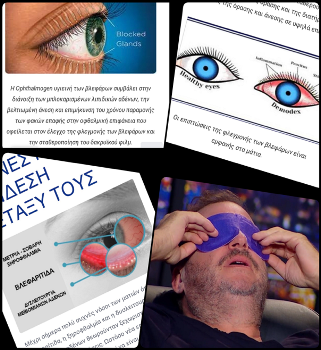 ophthalmogen 5a